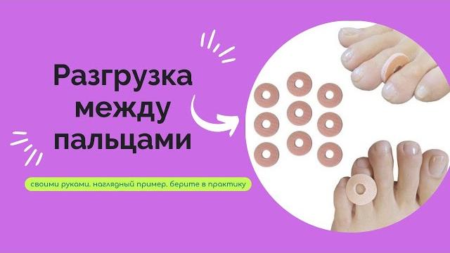 Как сделать разгрузку на мозоль между пальцами, если не умеешь делать ортез