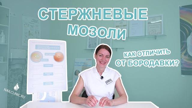 Стержневая мозоль. удаление стержневой мозоли.