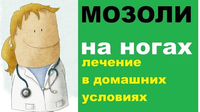 Мозоли на ногах: лечение в домашних условиях